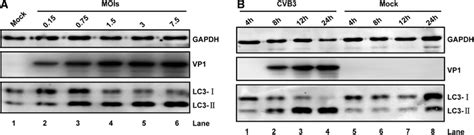 Formation Of Autophagosomes During CVB3 Infection A HEK293A Cells