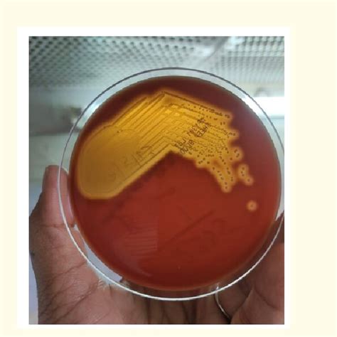 Streptococcal Agalactiae Showing Beta Hemolysis Image Taken With