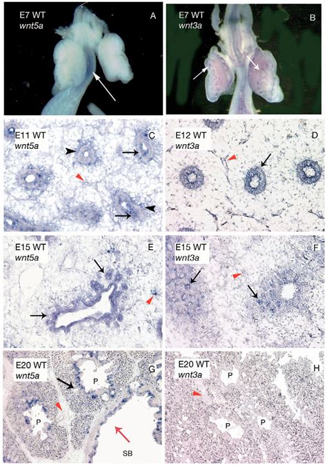 The Expression Patterns Of Wnt5a And Wnt3a Are Spatially And Temporally