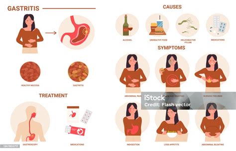 Gastritis Medical Infographics Disease Of Digestive Tract Causes Symptoms Treatment Stock