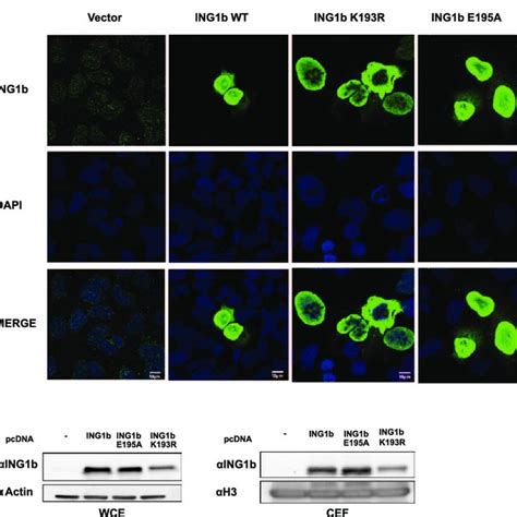 SUMOylation Does Not Alter ING1b Localization A U2OS Cells