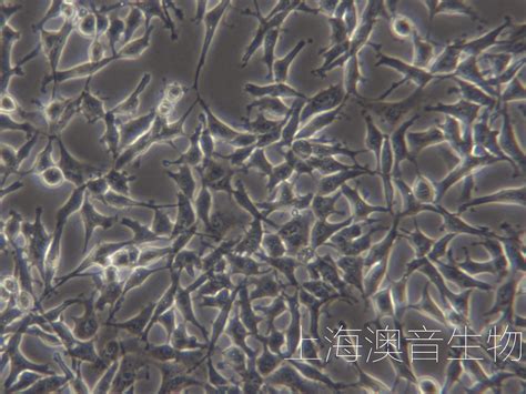 Es 2人卵巢透明细胞癌 企业官网