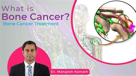 What Is Bone Cancer Bone Cancer Treatment Bone Marrow Transplant Specialist Dr Mangesh