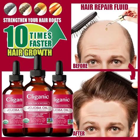 2022 New Hair Growth Oil Hair Growth Essence Hair Thinning Treatment