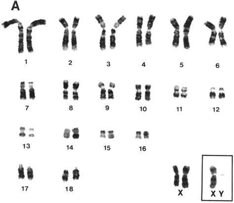 A Female G Banded Karyotype Of P C Capensis 2n 38 The Inset Download Scientific