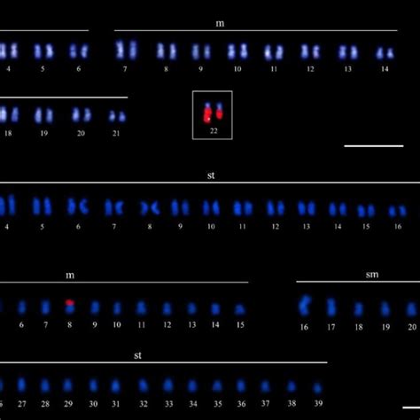 Fluorescence In Situ Hybridization With 18S RDNA Probe Red Blocks Of