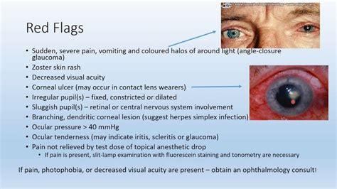 Red Eye in Primary Care - YouTube | Primary care, Skin rash, Red eye causes