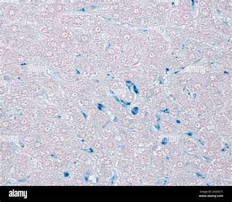 Liver Kupffer Cells Are Macrophages Related To The Liver Sinusoids