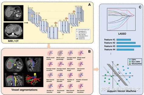 影像组学平台：基于ct和mri的血管模型诊断具有临床意义的门静脉高压症 知乎