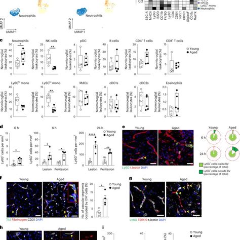 Aged Mice Exhibit Increased Neutrophil Plugging Of Brain Capillaries