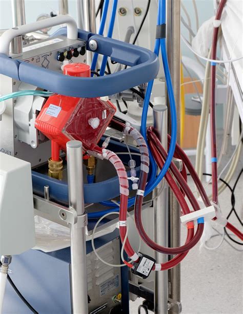 Extracorporeal Membrane Oxygenation Ecmo Machines Market Analysis