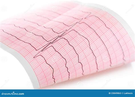 Cardiogram stock image. Image of diagnosis, diagram, electrocardiogram - 23849863