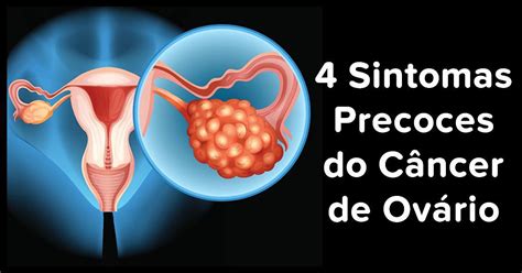 4 Sintomas que você precisa conhecer para uma detecção precoce do