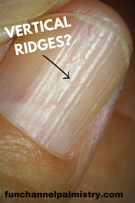 What Causes Vertical Ridges In Fingernails And Toenails Design Talk