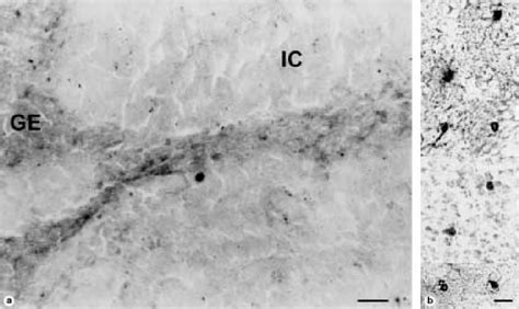 Figure 1 From Expression Of Oligodendrocyte Specific Proteinclaudin 11