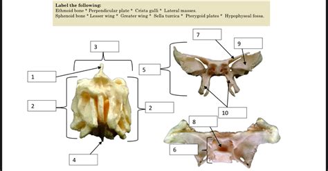 Ethmoid Bone Labeled Nasal Septum