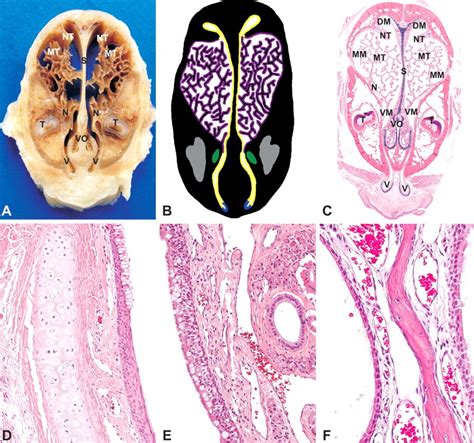 Human Nasal Cavity Histology