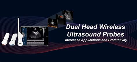 Real Time Ultrasound Machines Interaktiv Scan Real Time Ultrasound