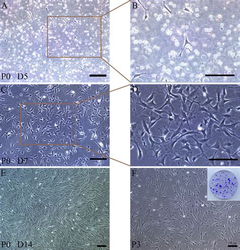 Morphology Of Adherent Cells Under Hypoxic Culture Conditions 5 O 2