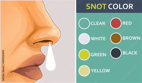 Human nose in profile. Nasal discharge. Color of nasal discharge. Healthcare illustration ...