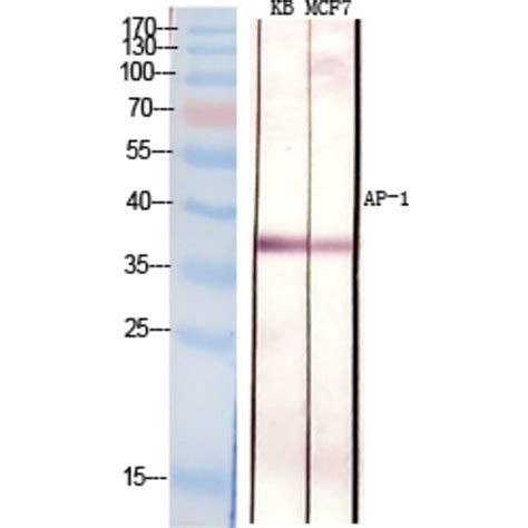 anti ap  antibody  antibodiescom