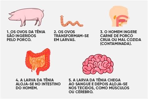 Cisticercose sintomas diagnóstico e ciclo de vida Tua Saúde