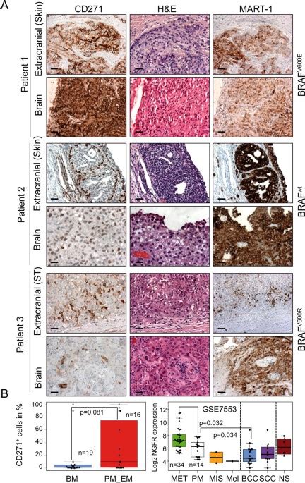 Cd Determines Migratory Properties Of Melanoma Cells Scientific