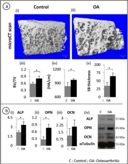 Understanding Sclerotic Bone Steinerbio