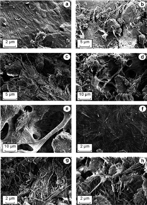 Scanning electron microscope micrographs showing shape, size and ... 
