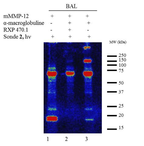 Membrane Pvdf Analys E En Radioactivit Montrant Le Bal En Pr Sence De