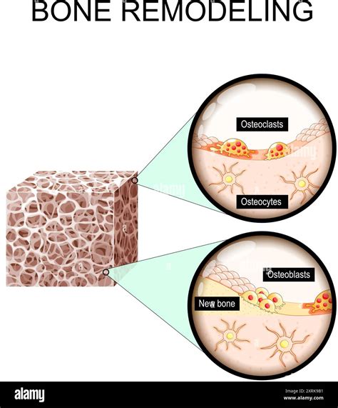 Osteoporosis Bone Matrix Stock Vector Images Alamy