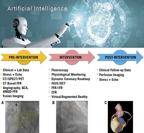 Robotics, imaging, and artificial intelligence in the catheterisation