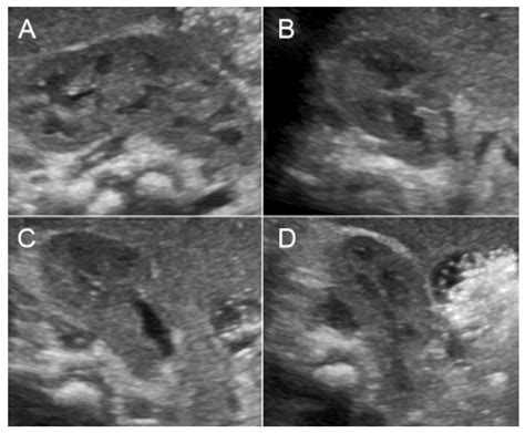 Diagnostics Free Full Text Prenatal Sonographic Features Of Charge Syndrome