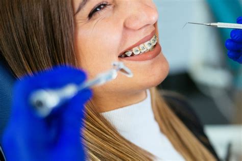 Cu Les Son Las Consecuencias De Retirarse Los Brackets Antes De Tiempo