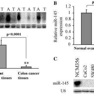 Overexpression of miR 145 inhibited VEGF and HIF 1α expression A