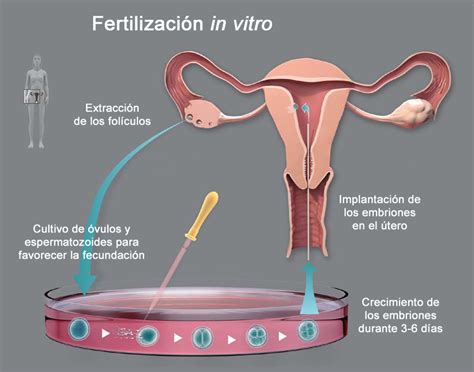 Hormonas Infertilidad Y Reproducción Asistida