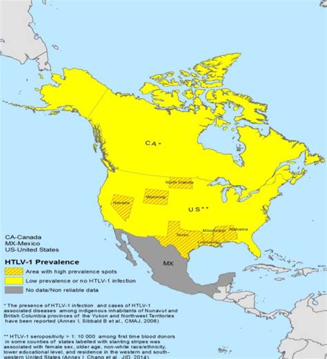 Adult T Cell Leukemia Epidemiology And Demographics Wikidoc