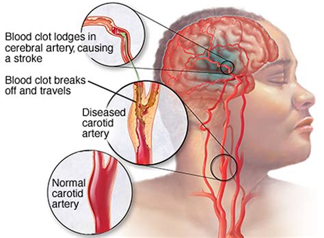 Voice Box Definition Location Anatomy Function