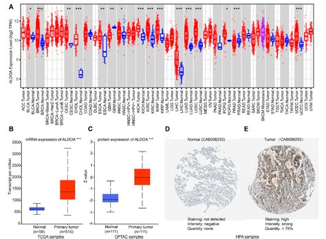 Figure 2 From Prognostic Implications And Immune Infiltration Analysis