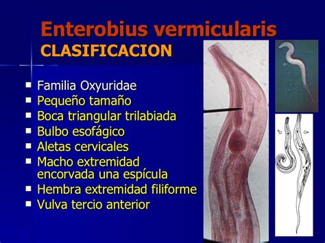 Enterobius Vermicularis Disease