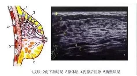 乳腺彩超那些事 科室动态 湘南学院附属医院