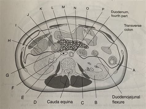 Fig 3 13 Transverse Section Through The Abdomen At The L2 Vertebral