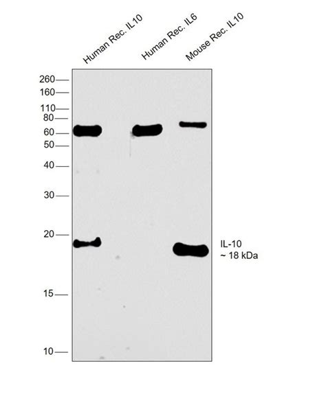 Il 10 Recombinant Rabbit Monoclonal Antibody 1h1l7 Invitrogen™ 100