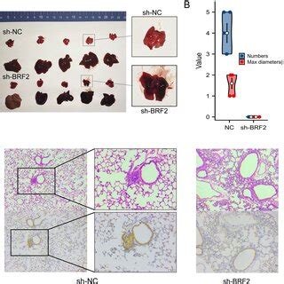 Brf Knockdown Inhibits Lung Metastasis Of Huh Cells In Vivo A A