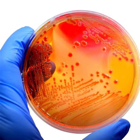 六种脑炎脑膜炎病原体核酸检测试剂盒荧光 PCR 法 病毒 水痘 球菌