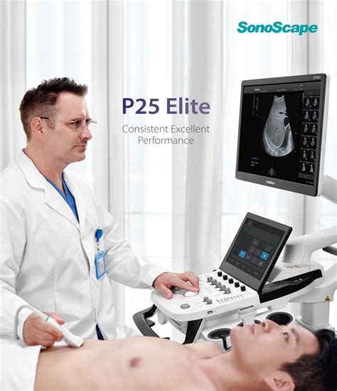 Sonoscape P25 Elite Trolley 3d4d Color Doppler Ultrasound Machine