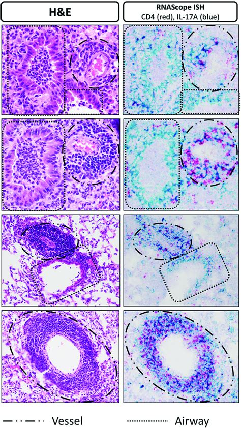 H E And RNAScope In Situ Hybridization Lung Histology Highlighting