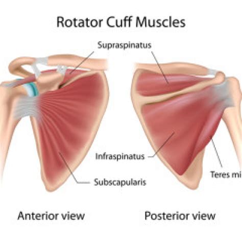 Rotator Cuff Pain Archview Physiotherapy Massage Dry Needling