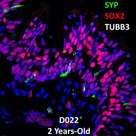 2 Year Old Human Lung Confocal Imaging Donor D022 SYP SOX2 And TUBB3