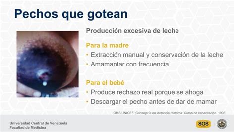 De Los Pezones Rotos A La Mastitis C Mo Prevenir Y Tratar Las